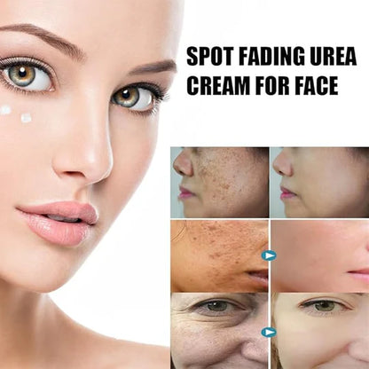 Spot Fading Urea Cream – Dark Spot & Freckle Remover