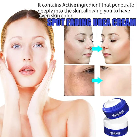 Spot Fading Urea Cream – Dark Spot & Freckle Remover