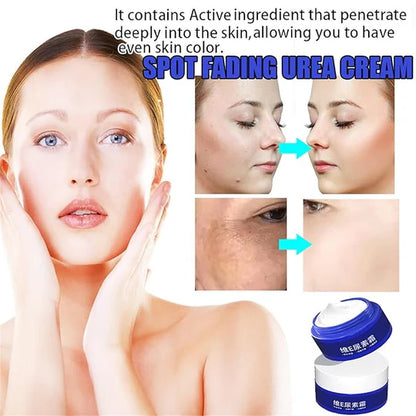 Spot Fading Urea Cream – Dark Spot & Freckle Remover