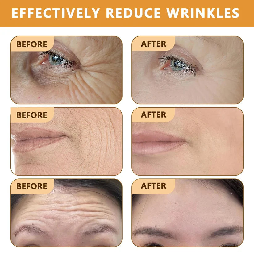 Botox Bee Venom Cream For Wrinkle