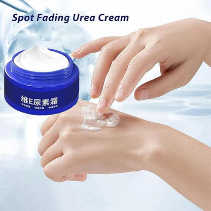 Spot Fading Urea Cream – Dark Spot & Freckle Remover