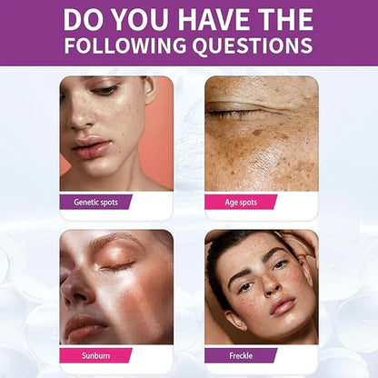 Spot Fading Urea Cream – Dark Spot & Freckle Remover