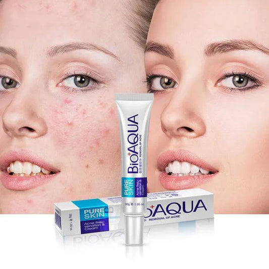 Bio Aqua Acne & Scar Removal Cream – Pimple & Dark Spot Treatment
