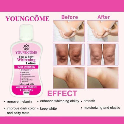 Youngcome Face & Body Whitening Lotion – Bright, Even & Glowing Skin