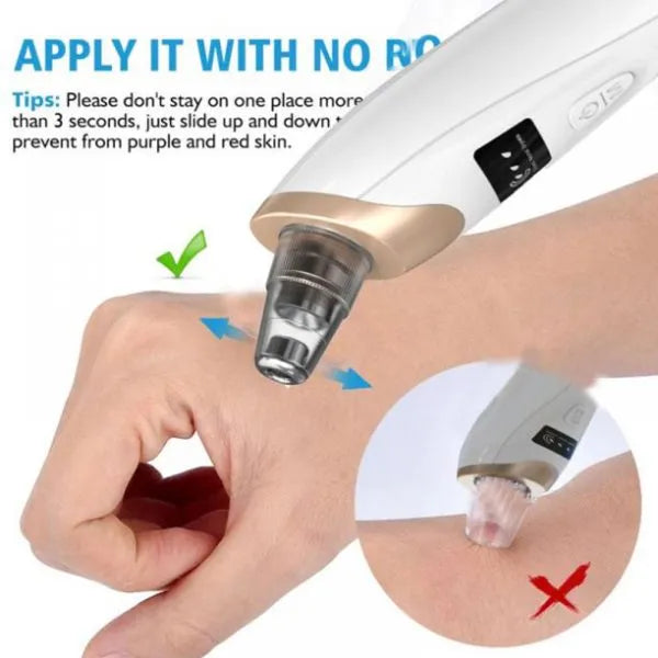Electric Blackhead Suction Remover | Vacuum Extractor for Clear Skin